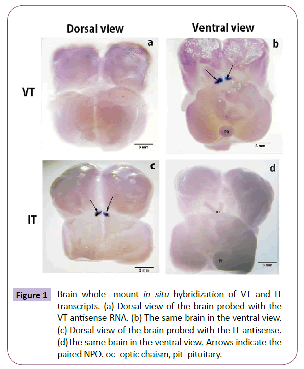 translational-neuroscience-pit-pituitary