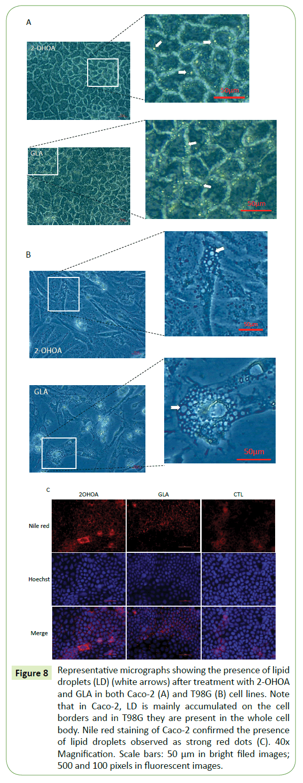 translational-neuroscience-presence-lipid